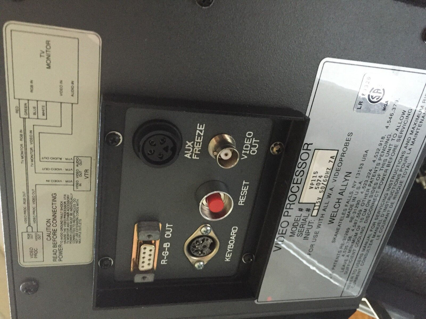 Welch  Vp115 ,Welch Allyn  Vp115  Video Probe-2000 Processor ,Aw
